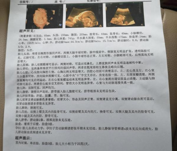 24周，剛出爐的四維