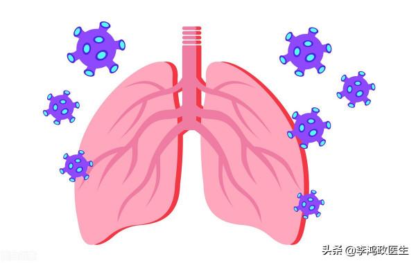 女子咳嗽，自行用藥不解，就醫發現癌症多處轉移，醫生：錯失良機