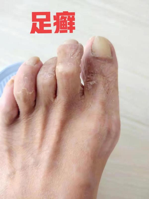 4種常見的面板病,教你最實用的識別和處理方法 4種常見的面板病,教你最實用的識別和處理方法