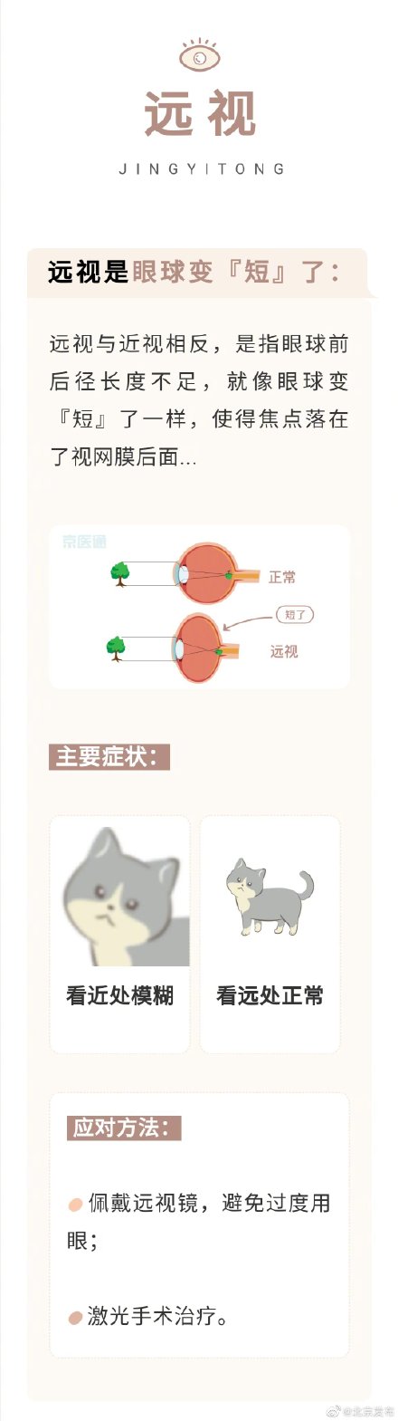 近視、散光、老花眼……到底有什麼不同，眼科醫生一句話告訴你