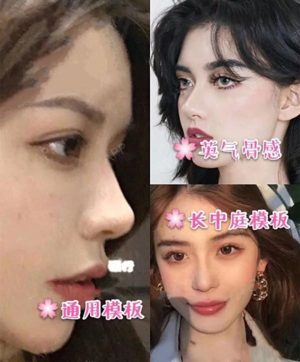 哪種鼻型才是大家追捧的“媽生自然鼻” 哪種鼻型才是大家追捧的“媽生自然鼻”