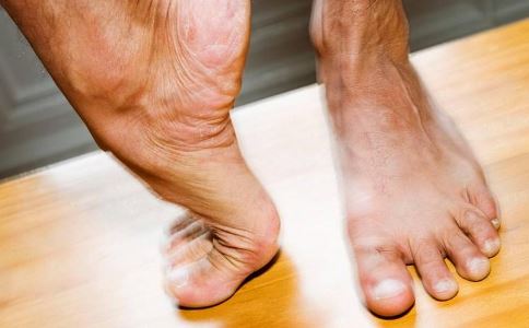 老年人糖尿病足如何護理？謹記4個方法