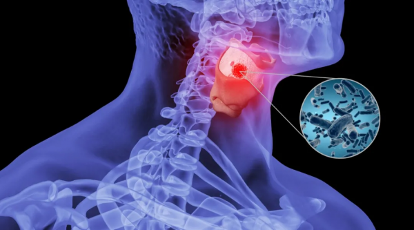 梅子的“最高境界”，是老祖宗的“護咽法寶”