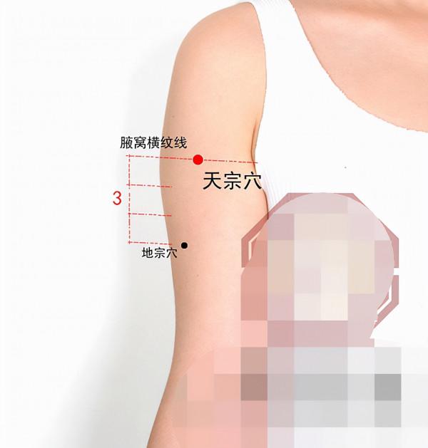 中醫針灸上肢疾病處方6 中醫針灸上肢疾病處方6