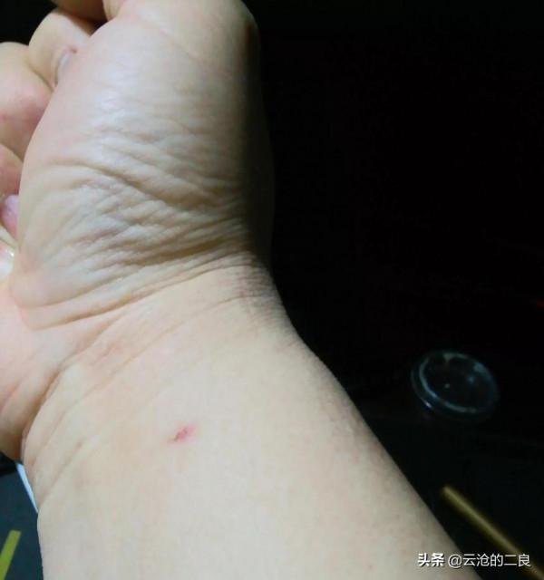 心臟支架術後恢復運動打卡第11天