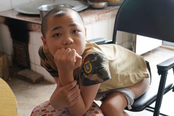 女子意外懷孕後不顧反對生下雙胞胎，醫生看後斷言：活不過18歲