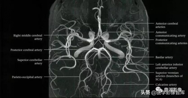 CT斷層解剖圖譜最全總結「推薦收藏」 CT斷層解剖圖譜最全總結「推薦收藏」