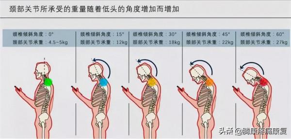 關於這七個引起背痛的姿勢,可能你每天都在做 關於這七個引起背痛的姿勢,可能你每天都在做