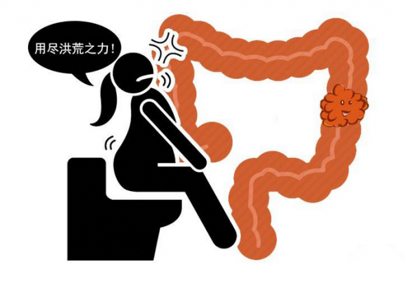 腸道生病，3個訊號明顯，及早治療，別讓&OpenCurlyDoubleQuote;腸壽&rdquo;影響你的長壽