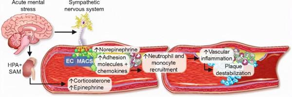 「生氣」如何一步步誘發心梗?《歐洲心臟雜誌》找到了真兇 「生氣」如何一步步誘發心梗?《歐洲心臟雜誌》找到了真兇