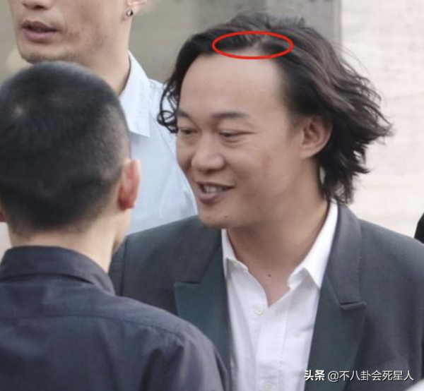 10位中年男星“禿頂”大賞:黃曉明、沙溢頭頂稀疏,最意外是他 10位中年男星“禿頂”大賞:黃曉明、沙溢頭頂稀疏,最意外是他