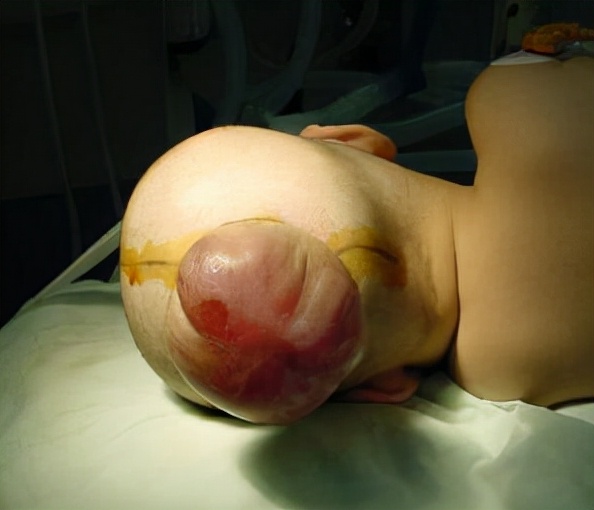 妊娠期常見導致畸形的藥物及畸形的表現 妊娠期常見導致畸形的藥物及畸形的表現