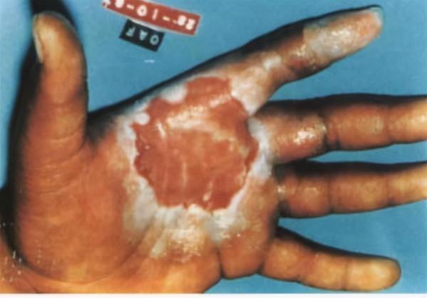 1987年，巴西兩蠢賊偷走了19克藍色發光粉末，數日毀滅半個城市