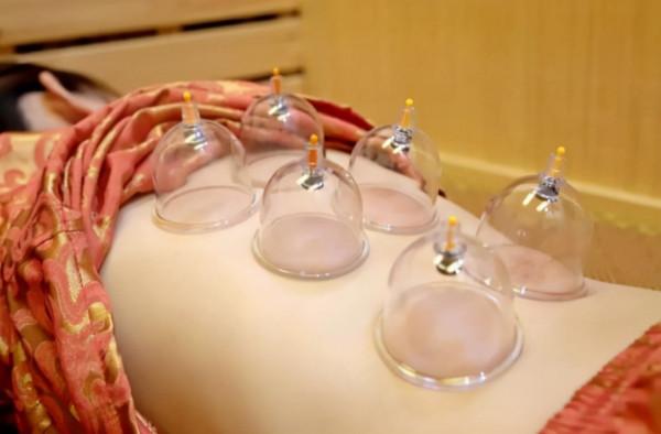 拔火罐時,後背吸出來的瘀血,真的是毒素嗎?醫生告訴你實話 拔火罐時,後背吸出來的瘀血,真的是毒素嗎?醫生告訴你實話