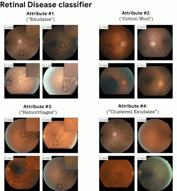 分類器視覺化解釋StylEx:谷歌等找到了影響影象分類的關鍵屬性 分類器視覺化解釋StylEx:谷歌等找到了影響影象分類的關鍵屬性