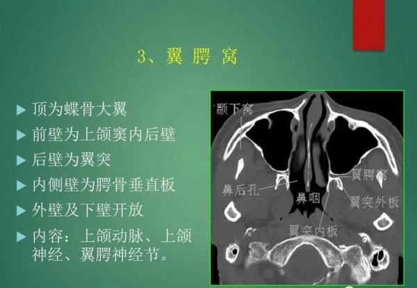 頭頸五官CT斷層解剖圖及常見病影像診斷