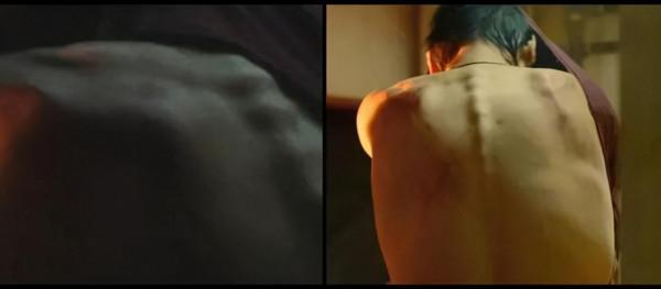 悲劇！他們瘦了反而更難看了？