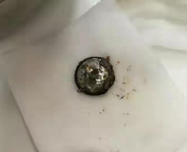 英國2歲男嬰誤吞紐扣電池，心臟被燒傷去世！小電池為何這麼毒？