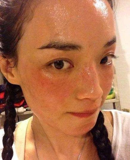 吃豬肉會醉、聞香蕉會窒息、不能接觸空氣？女星的過敏真活久見