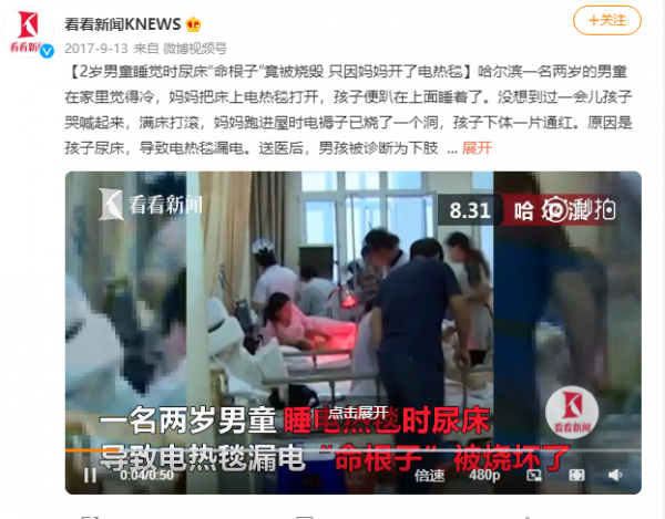 心疼!1歲幼童尿床後被電熱毯燒傷…… 心疼!1歲幼童尿床後被電熱毯燒傷……