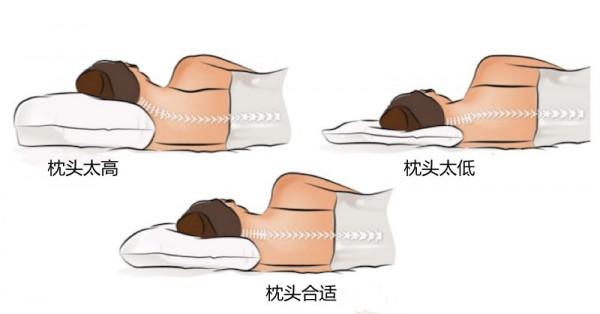 後腦勺痛,眼眶痛,大腦有問題?一般是這3種原因 後腦勺痛,眼眶痛,大腦有問題?一般是這3種原因