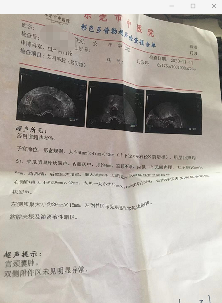 做了個手術,要二胎的心願越來越強烈 做了個手術,要二胎的心願越來越強烈