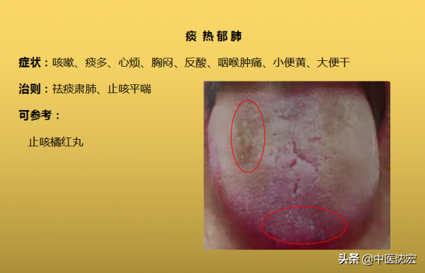 4種&OpenCurlyDoubleQuote;熱&rdquo;藏於體內，不同舌象，不同症狀，建議收藏分享給朋友