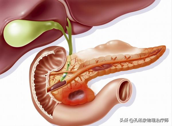 肩膀疼痛是咋回事？為啥不是肩周炎？本文告知您原因