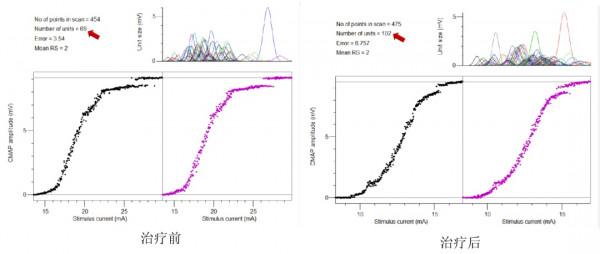 手麻到底是為什麼？這個檢查可以查出來哦