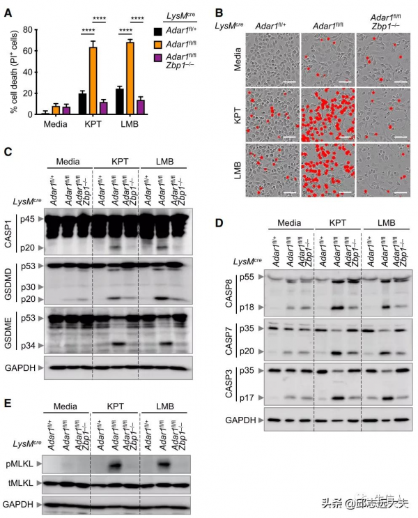 細胞死亡領域缺失的一塊拼圖:PANoptosis 細胞死亡領域缺失的一塊拼圖:PANoptosis