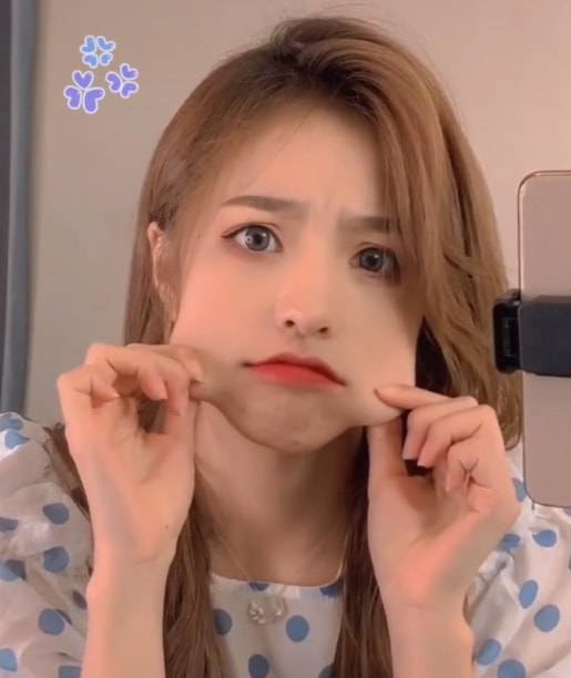 劉思瑤整容“實錘”？整容醫院拿她當成功案例，網友：方臉能整嗎