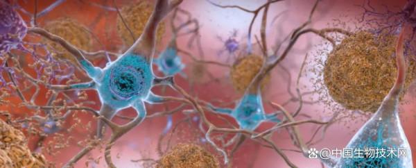 新研究：熬夜會降低巨噬細胞吞噬有毒蛋白的效率，增加痴呆症風險