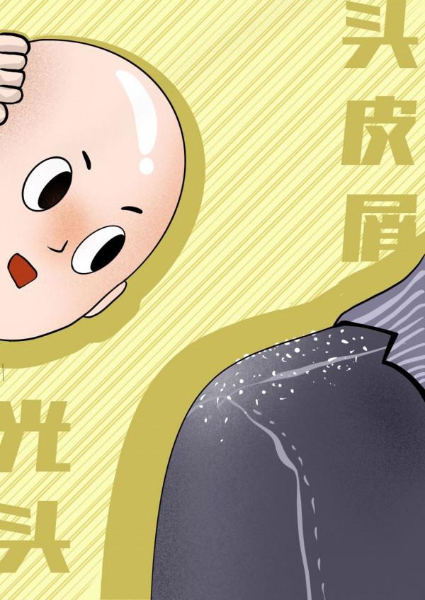 科學密探 | 剃成光頭還會有頭屑嗎？