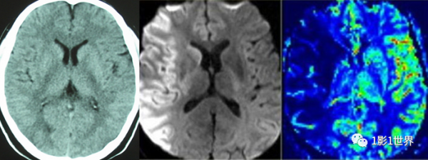 影像檢查“未見異常”就說明沒事嗎？
