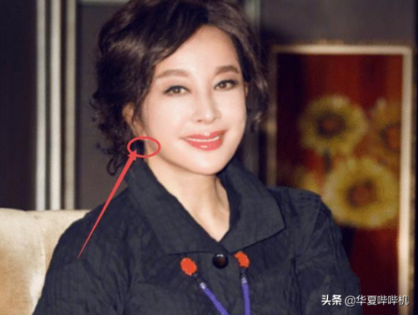 明星大型“翻車”現場，她們是如何整容變毀容的