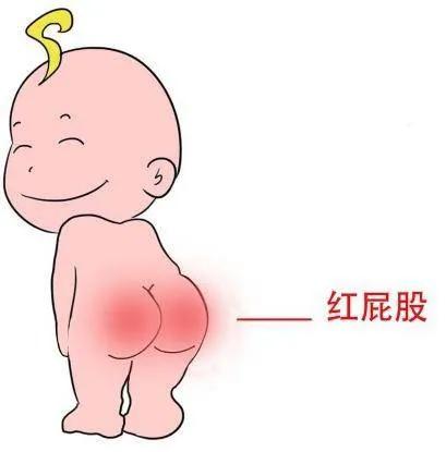 給新手媽媽六點應付寶寶紅屁屁的建議 給新手媽媽六點應付寶寶紅屁屁的建議