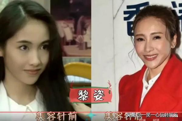 被“美容針”摧殘的女星，戚薇笑都不自然，舒暢真成“天山童姥”