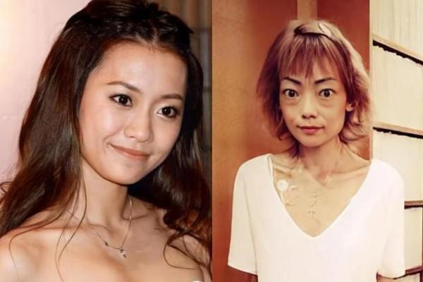 伍智恆：遭豪門男友說胖，瘦到44斤仍被嫌棄，父親深情守候後清醒