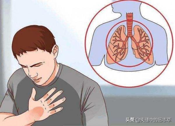 肺虛久咳？源於肺失肅降，送你三味中藥，降氣豁痰，兼可消食