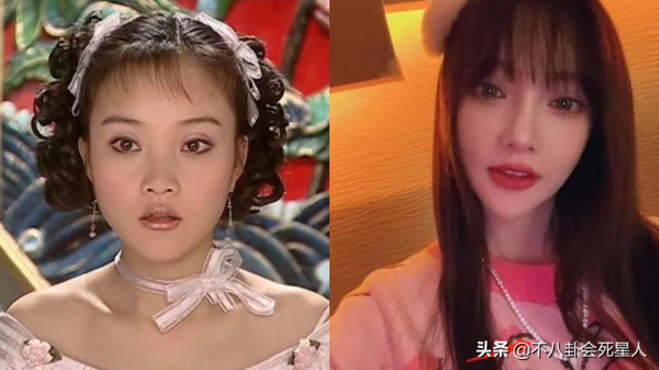 明星動下巴千奇百怪，李小璐又尖又翹，孫菲菲不願照鏡子