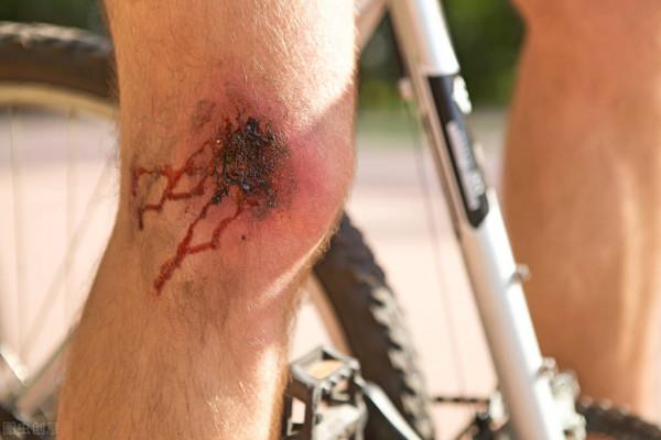 家裡的棗樹頻繁遭雷擊，原來是這樣，雷雨天氣要注意了