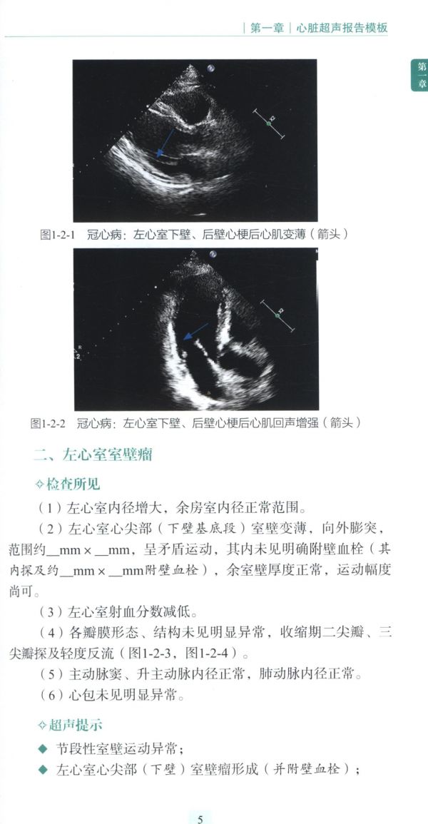 北京三甲醫院是如何寫超聲規範化診療及報告模板的？
