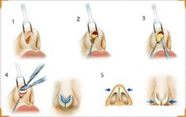 “假臉”大比拼?薛之謙變化大、羅志祥五官前後對比驚人 “假臉”大比拼?薛之謙變化大、羅志祥五官前後對比驚人
