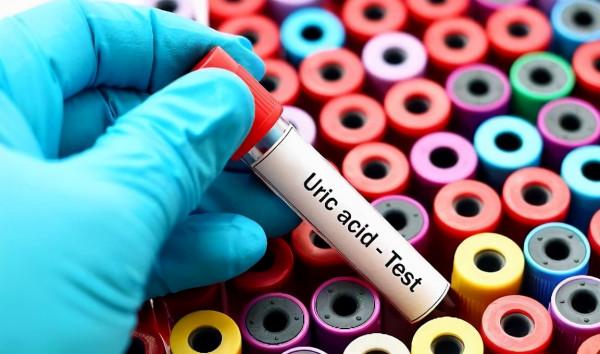 這種水果是“降酸王”，尿酸高的人群建議多吃