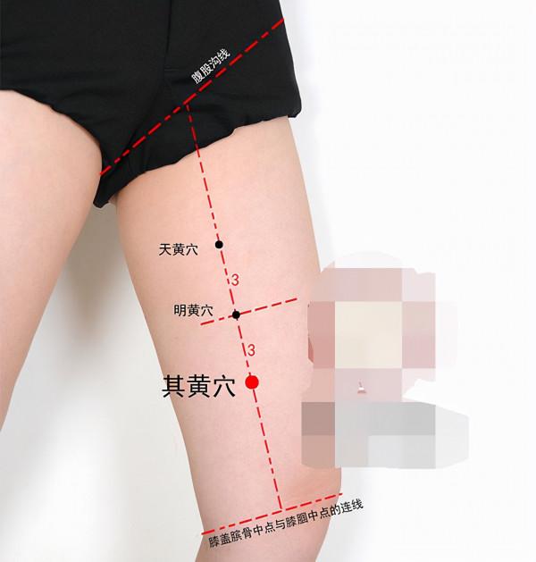 中醫針灸上肢疾病處方6 中醫針灸上肢疾病處方6