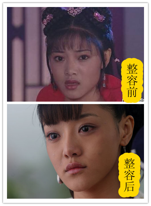 整容整毀的女星 整容整毀的女星