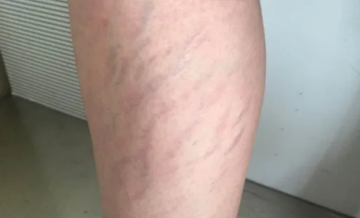 難怪你瘦不下來!原來是因為這些問題 難怪你瘦不下來!原來是因為這些問題