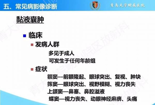 頭頸五官CT斷層解剖圖及常見病影像診斷