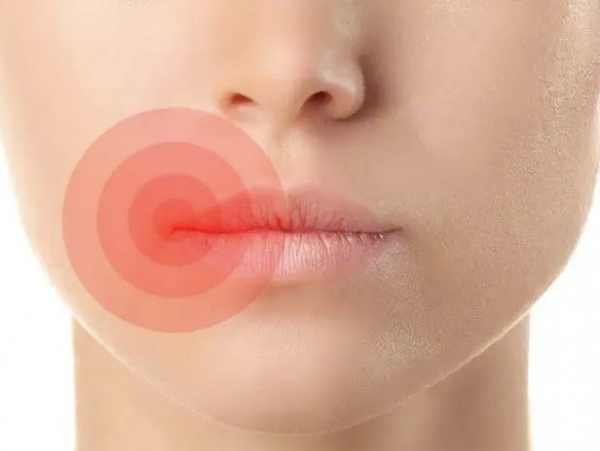 “脾開竅於口，其華在唇”從寶寶唇齒辨別身體狀況