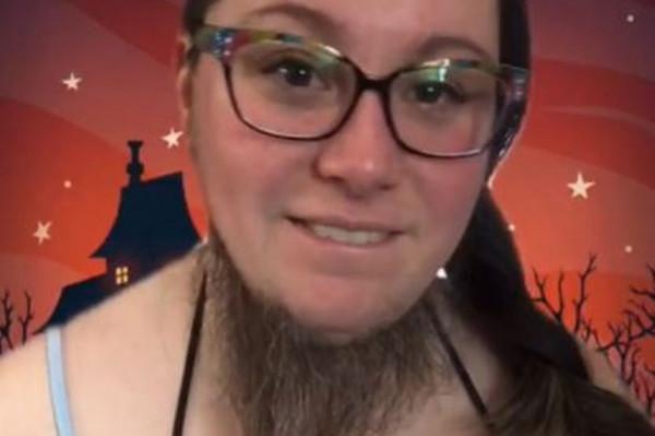 美國女子毛髮旺盛，曾感到很羞愧，如今大方曬出鬍子覺得自豪